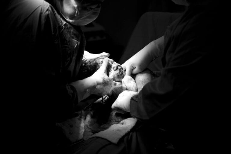 Black and white photo capturing a newborn's first moments in a surgical setting.